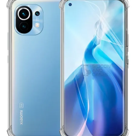 Carcasa Xiaomi Mi 11 Transparente Antigolpe — vista 2