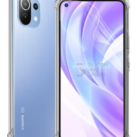 Carcasa Xiaomi Mi 11 Lite Transparente Antigolpe — vista 2